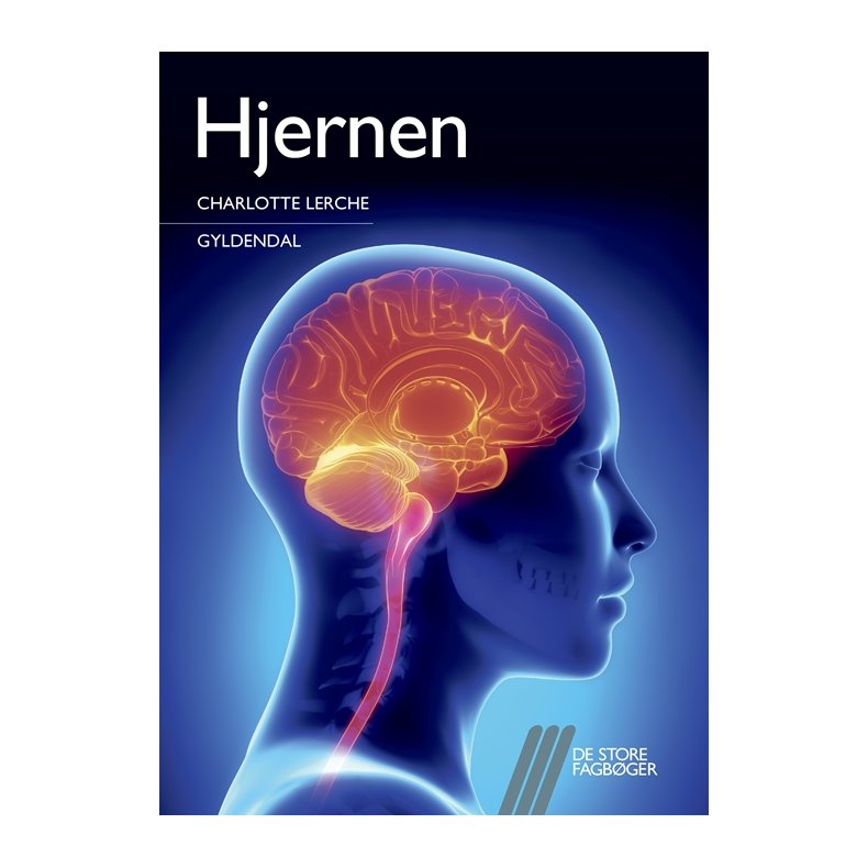 Hjernen 