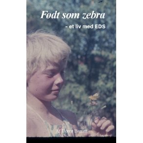 Fdt som Zebra - et liv med EDS